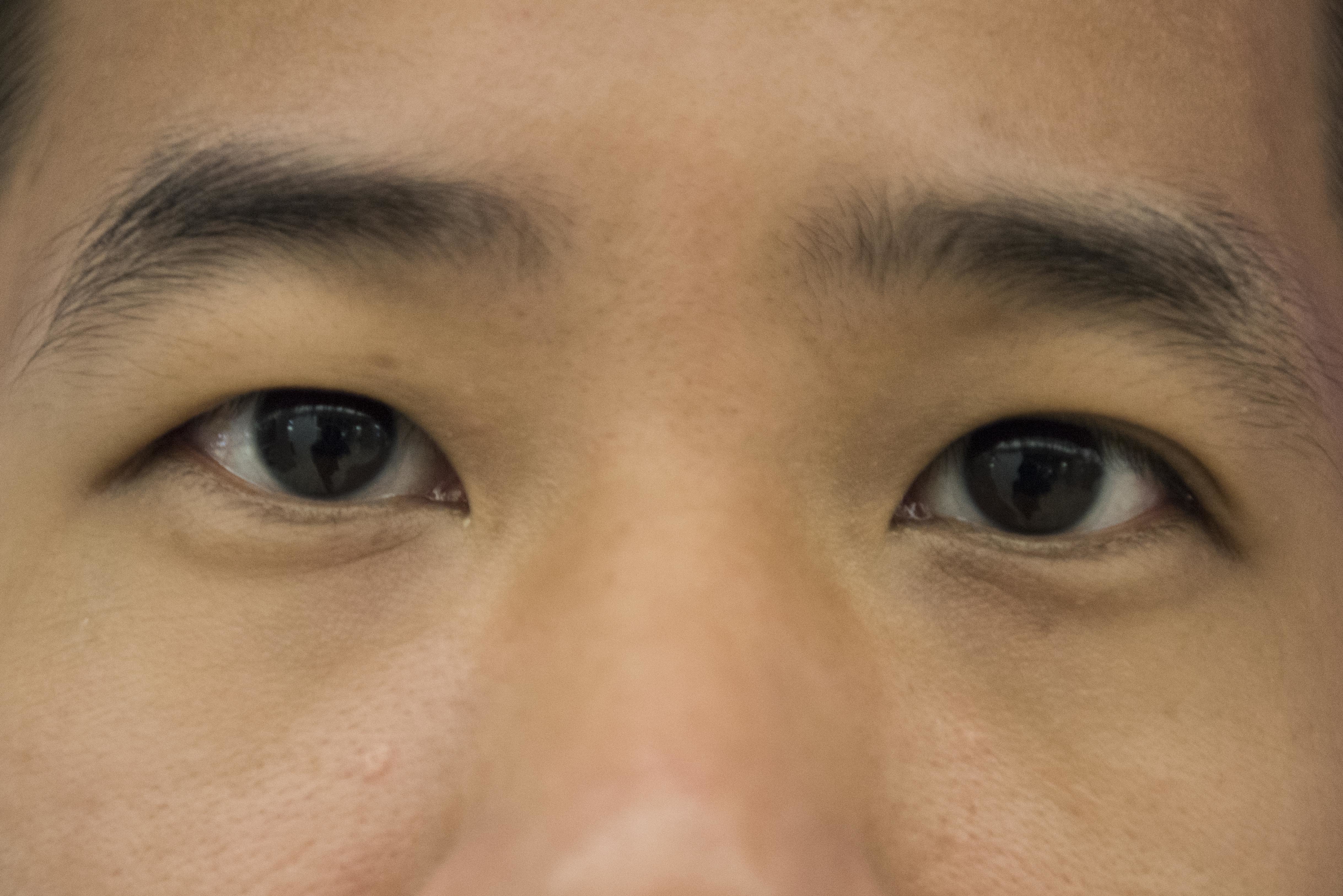 Difference Between Asian Eyes